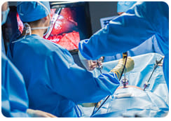 Cirugía laparoscópica
